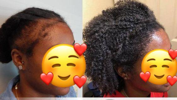 The Mane Magic Hair Growth Pomade & Hair Growth oil set