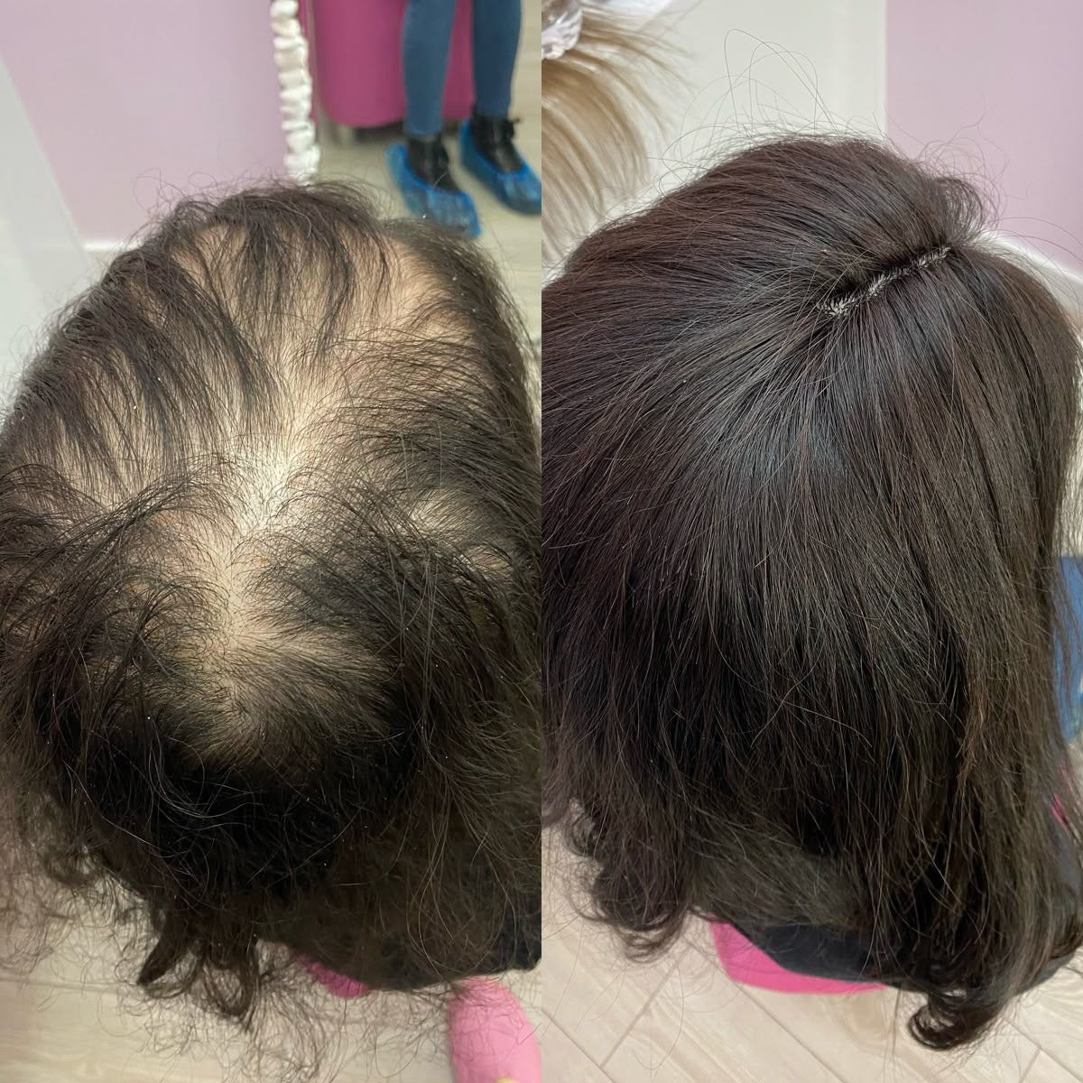 The Mane Magic Hair Growth Oil 4oz Haircare with 35 organic ingredients to stimulate and promote healthy and hair growth